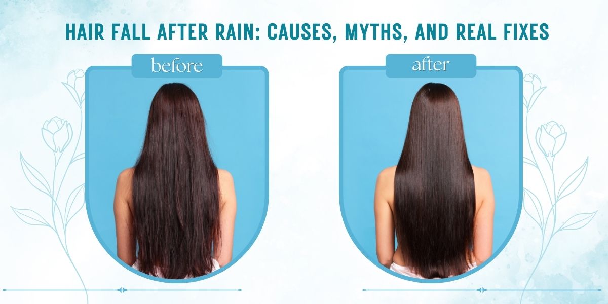 Hair Fall After Rain: Causes, Myths, and Real Fixes