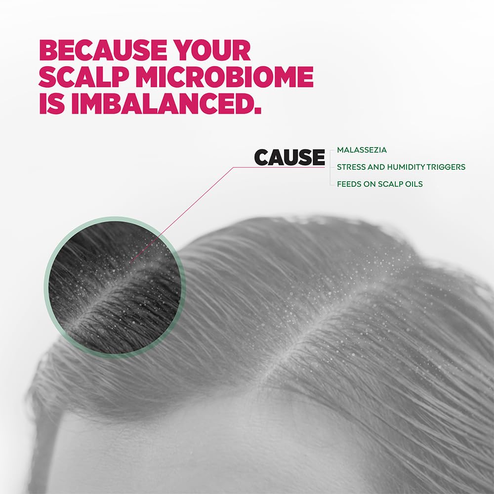 Sebamed Anti Dandruff Shampoo 200 ml | pH 5.5 | Controls Dandruff & Scalp Itching | Piroctone Olamine Formula | SLS, Paraben & Toxin Free