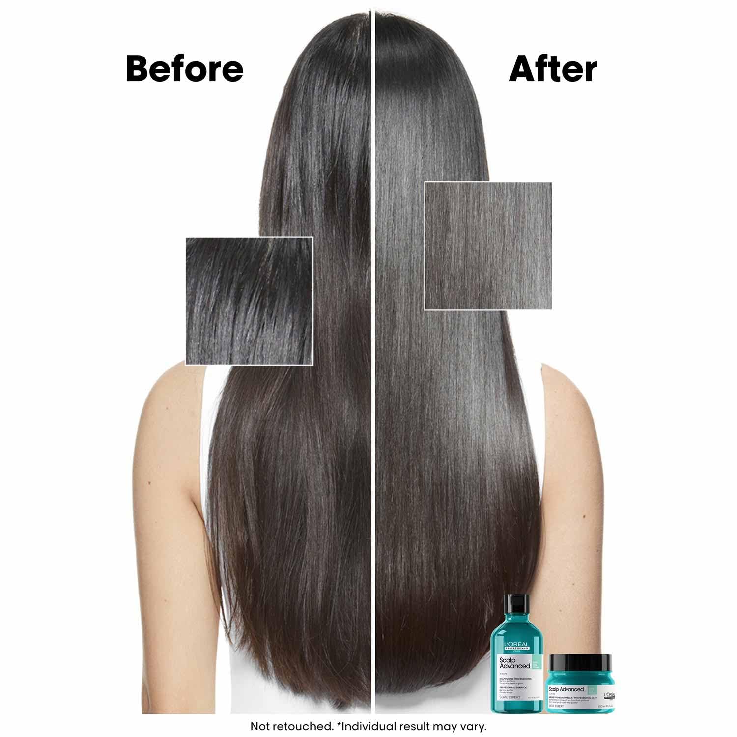 L’Oréal Professionnel Scalp Advanced Anti-Oiliness Dermo-Purifier Shampoo 300ml Loreal Professional