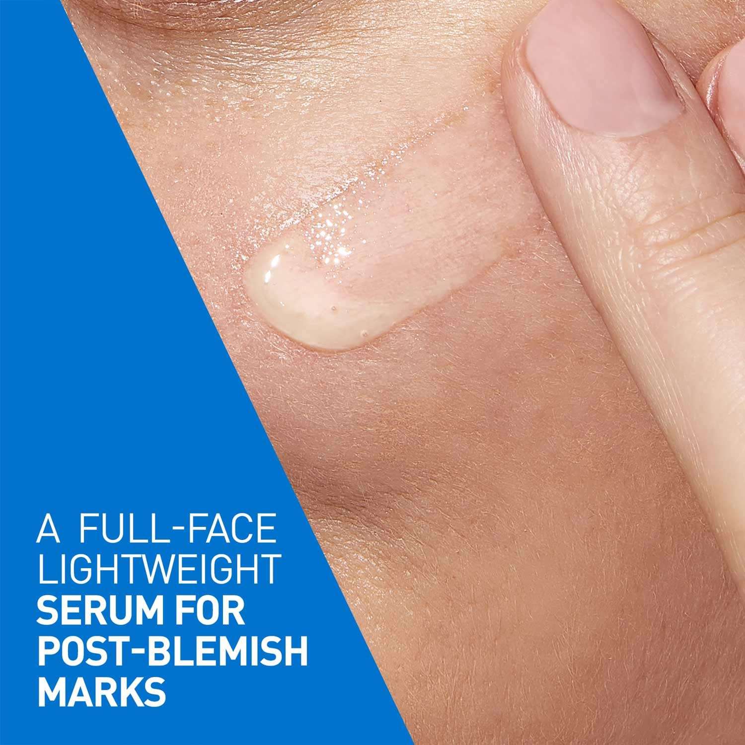 CeraVe Resurfacing Retinol Serum, Reduces Acne Marks with Licorice Root Extract & Niacinamide (30ml) CeraVe