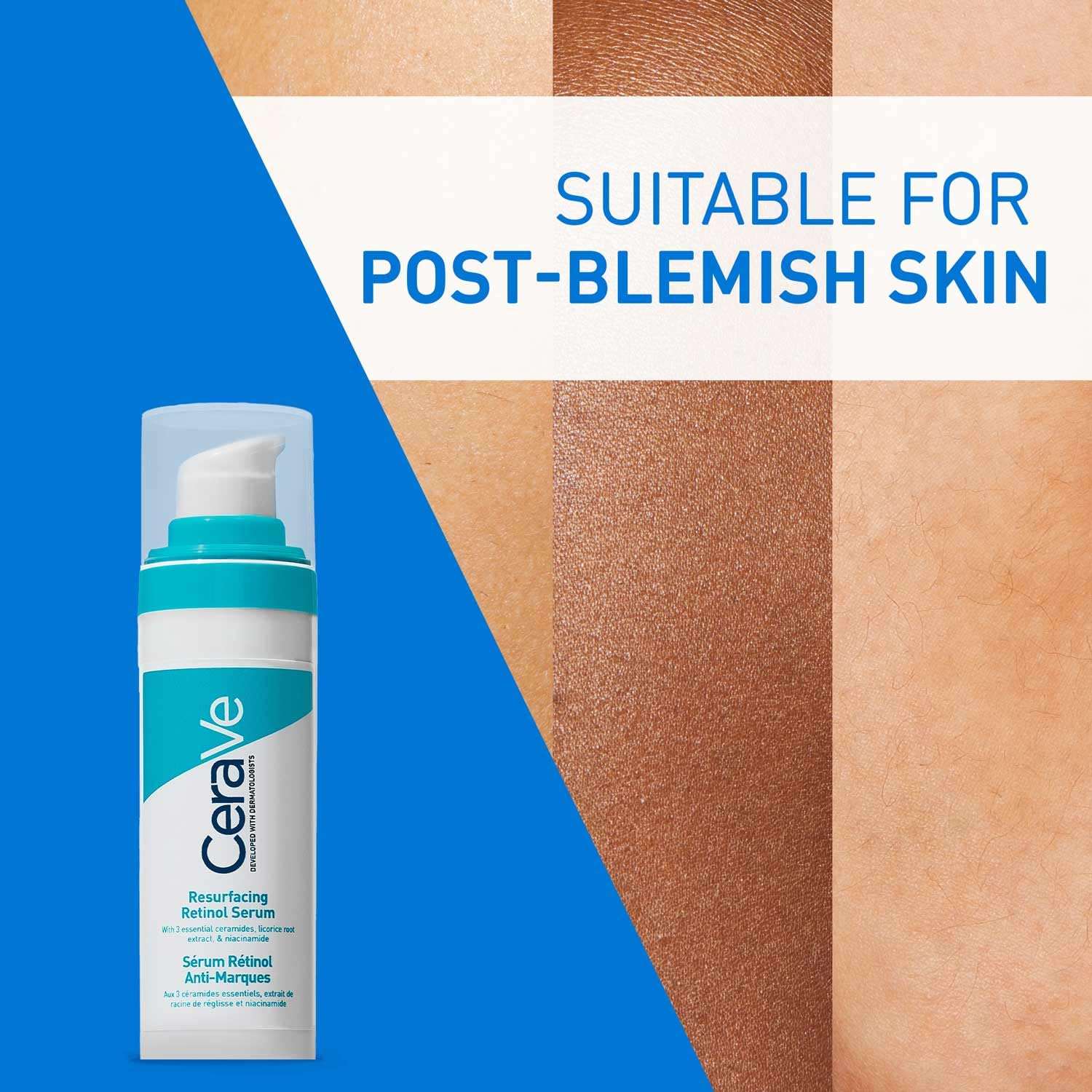 CeraVe Resurfacing Retinol Serum, Reduces Acne Marks with Licorice Root Extract & Niacinamide (30ml) CeraVe