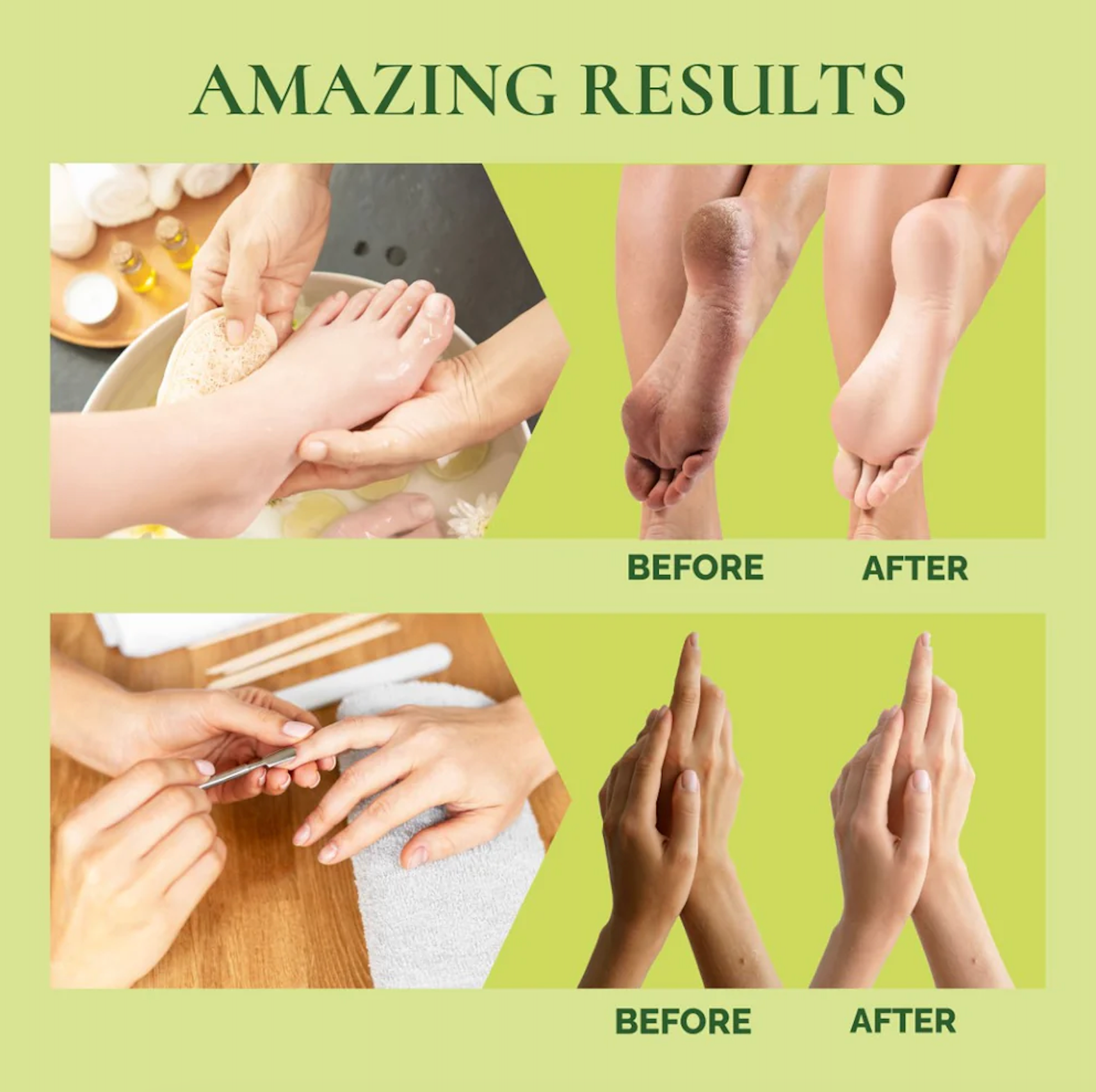 Before and after images of foot and hand care routines with text 'Amazing Results' on a green background.