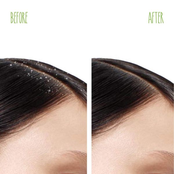 Matrix Biolage Advance Scalppure Dandruff Shampoo (200ml) - Niram Global Private Limited