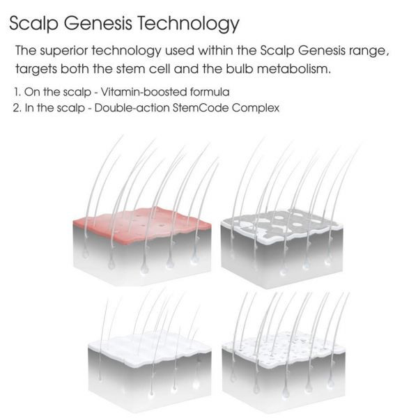 Schwarzkopf Professional BC Bonacure SG Root Activating Shampoo (200ml) Schwarzkopf