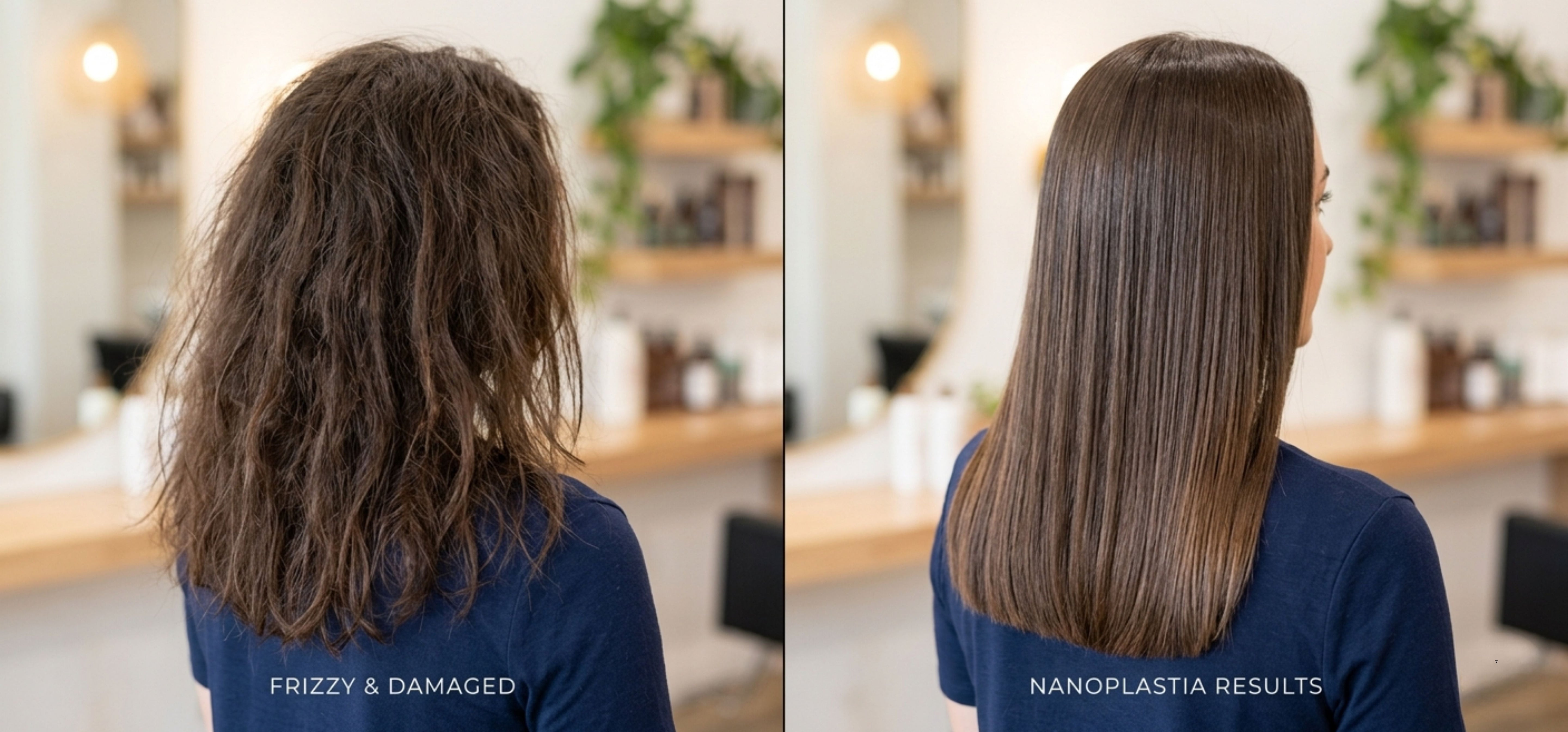 Before and After Results of Floractive Nanoplastia