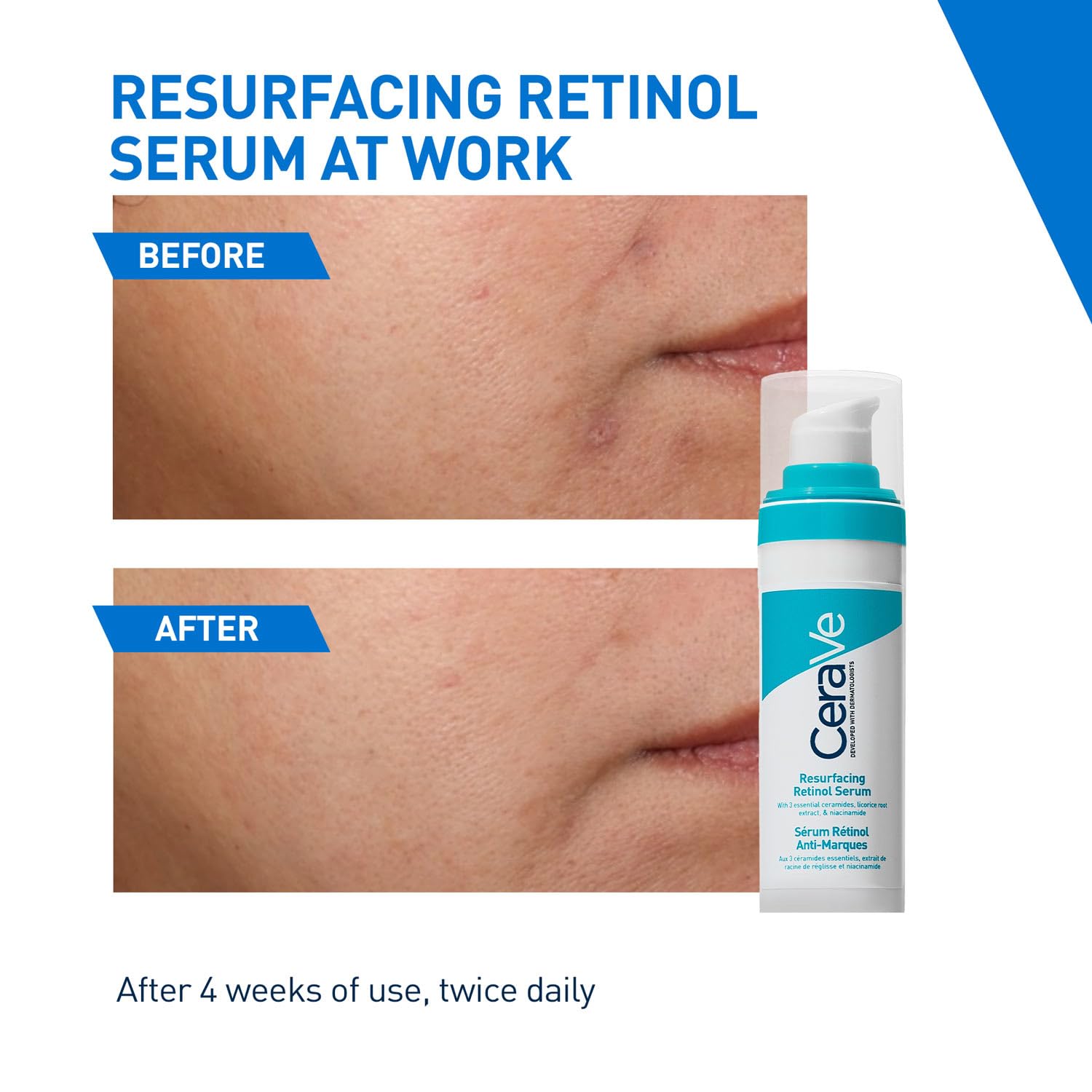 CeraVe Resurfacing Retinol Serum, Reduces Acne Marks with Licorice Root Extract & Niacinamide (30ml) CeraVe