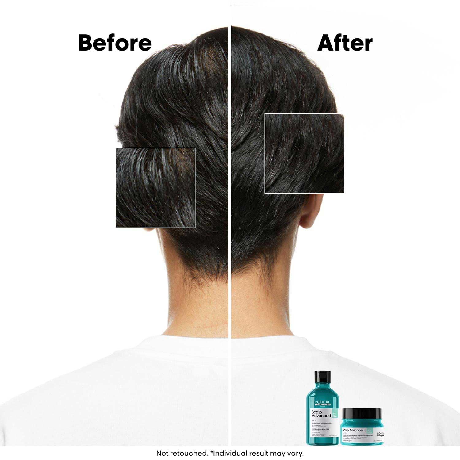 L’Oréal Professionnel Scalp Advanced Anti-Oiliness Dermo-Purifier Shampoo 300ml Niram Global Private Limited