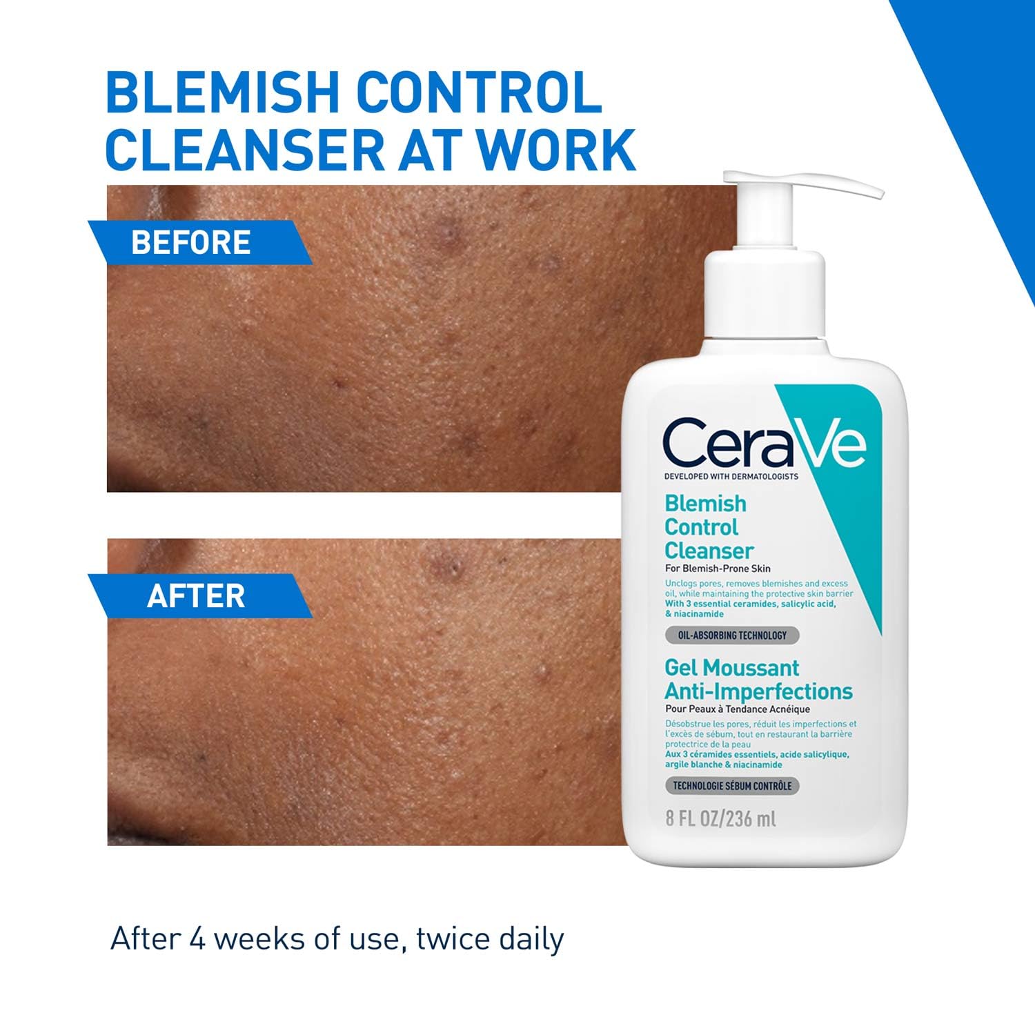 CeraVe Blemish Control Cleanser with 2% Salicylic Acid & Niacinamide for Acne-prone skin (236ml) CeraVe