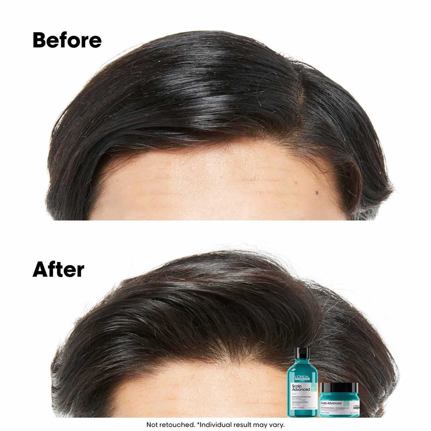 L’Oréal Professionnel Scalp Advanced Anti-Oiliness Dermo-Purifier Shampoo 300ml Niram Global Private Limited