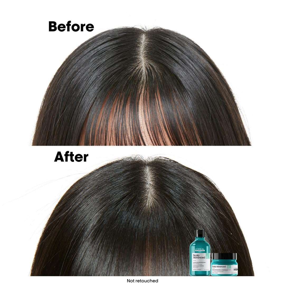 L’Oréal Professionnel Scalp Advanced Anti-Oiliness 2-in-1 Deep Purifier Clay 250 g | With 3% AHA + 6% Clay | Purifies Very Oily Scalps | For Men & Women Loreal Professional