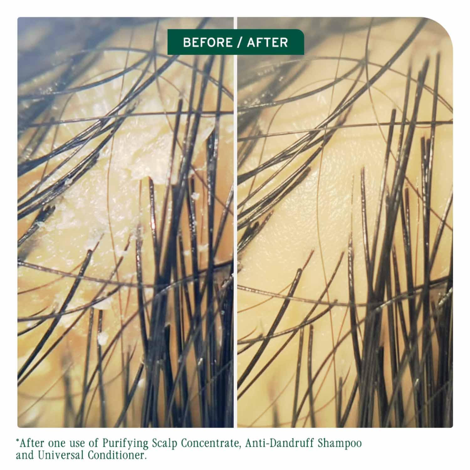 Biolage Scalp Sync Universal Conditioner For All Scalp Types (100ml) Matrix