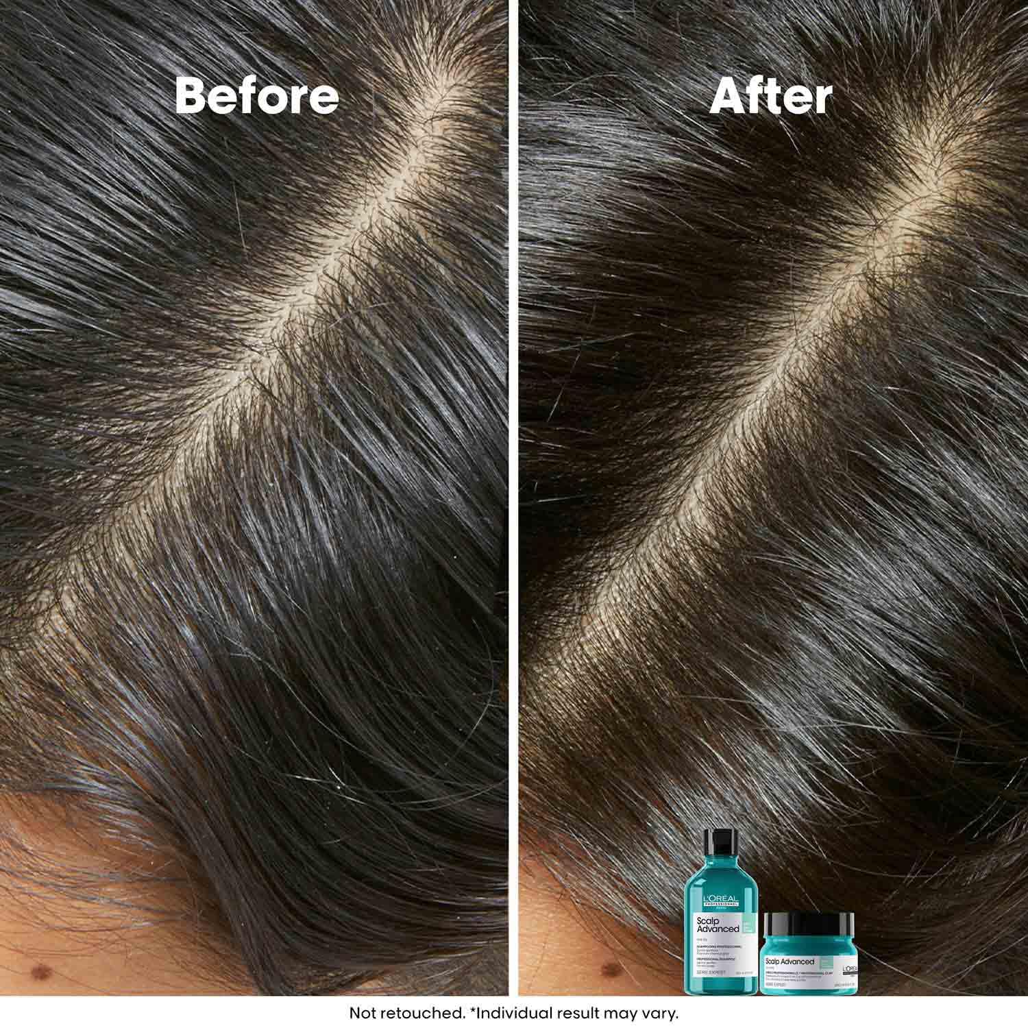 L’Oréal Professionnel Scalp Advanced Anti-Oiliness Dermo-Purifier Shampoo 300ml Niram Global Private Limited
