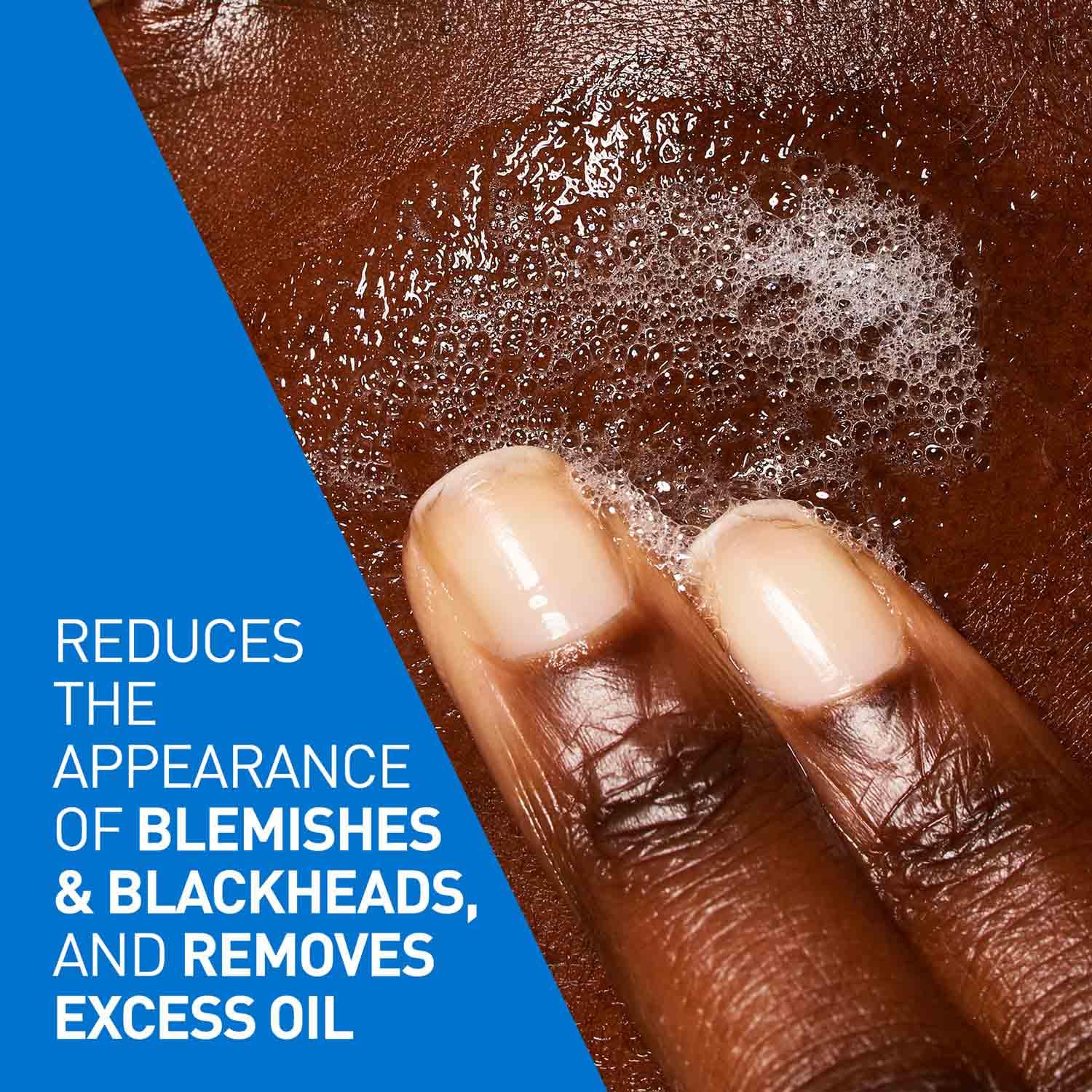 CeraVe Blemish Control Cleanser with 2% Salicylic Acid & Niacinamide for Acne-prone skin (236ml) CeraVe