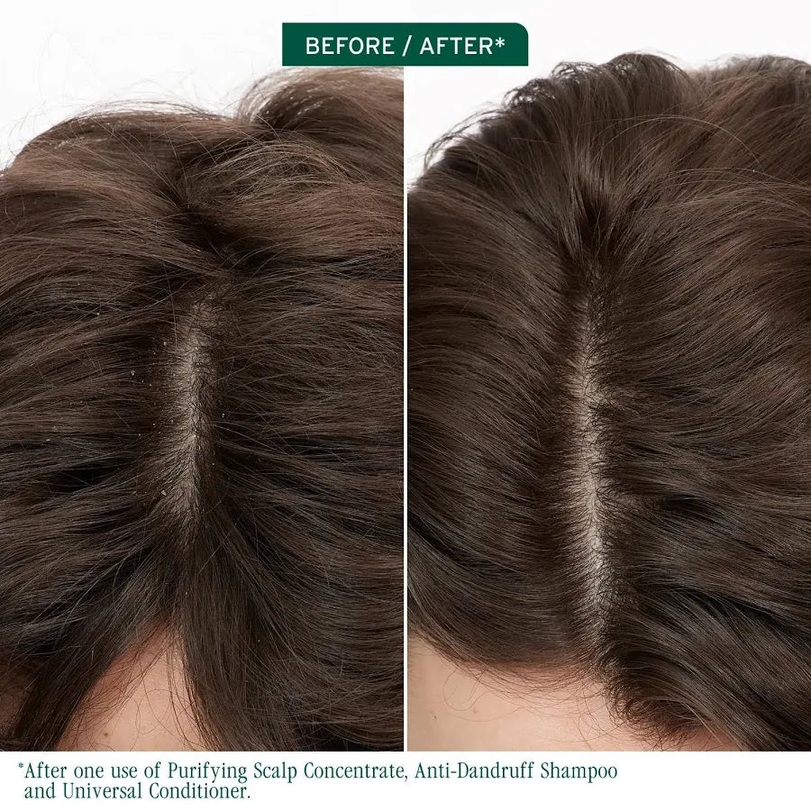 Biolage Scalp Sync Anti-Dandruff Concentrate (200ml) Matrix